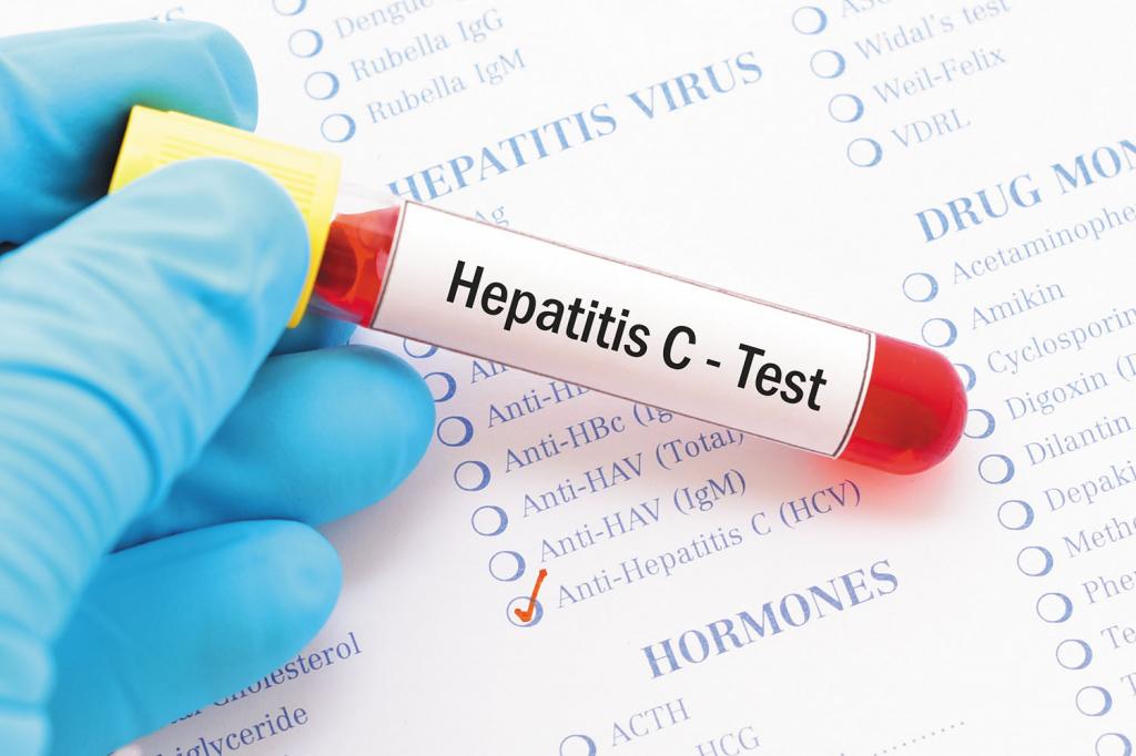 Hepatitis С