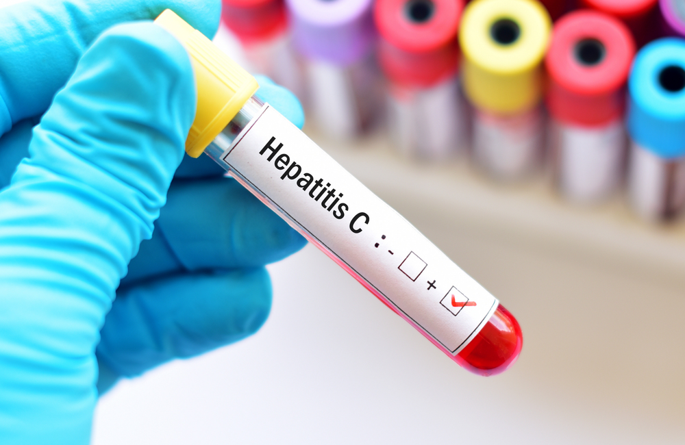 Hepatitis С